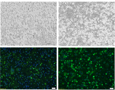 Light microscope images (top row) of a PRRSV vaccine and field strain with corresponding immunofluorescence images (bottom row). Photo: Dr Kristin Heenemann 