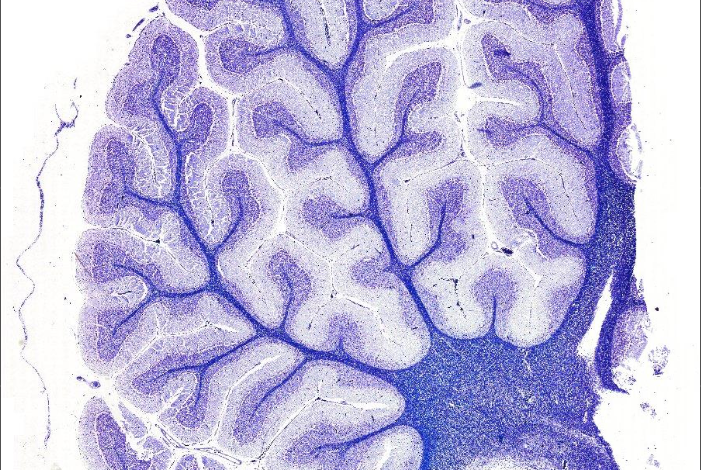 Das Kleinhirn vom Rind offenbart im digitalen Live Imaging spannende Tiefen und Strukturen bis in die kleinste Zelle. Quelle: cuvm.uni-leipzig.de