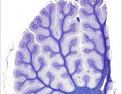 Das Kleinhirn vom Rind offenbart im digitalen Live Imaging spannende Tiefen und Strukturen bis in die kleinste Zelle. Quelle: cuvm.uni-leipzig.de