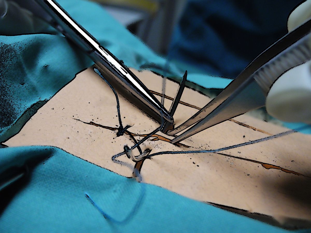 enlarge the image: abstracted close-up of forceps, needle and needle holder during suturing on a silicone suturing pad