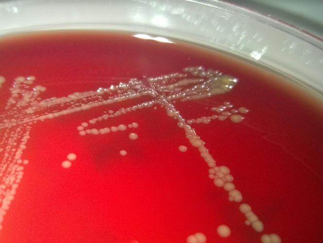 Blood agar plate with Rodentibacter heylii