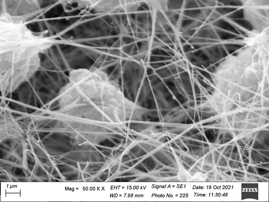 zur Vergrößerungsansicht des Bildes: REM-Bild des Biofilms in einem Venenkatheter vom Pferd. Probe CPD getrocknet, besputtert und im Hochvakuum mikroskopiert. Foto: Dr. Reinert