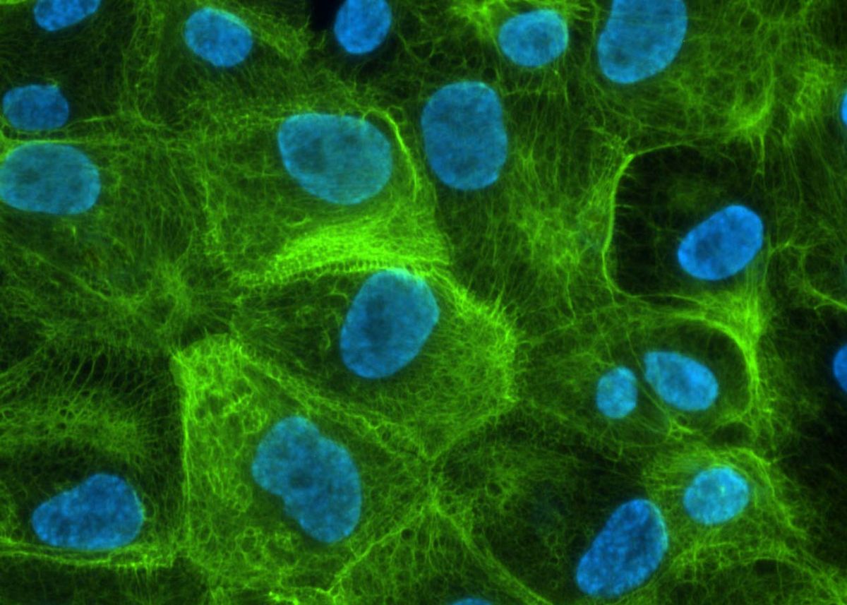 zur Vergrößerungsansicht des Bildes: Gefärbte Zellkerne und Cytoceratin-Gerüst der PoCo83-Zelllinie, Foto: Helga Pfannkuche