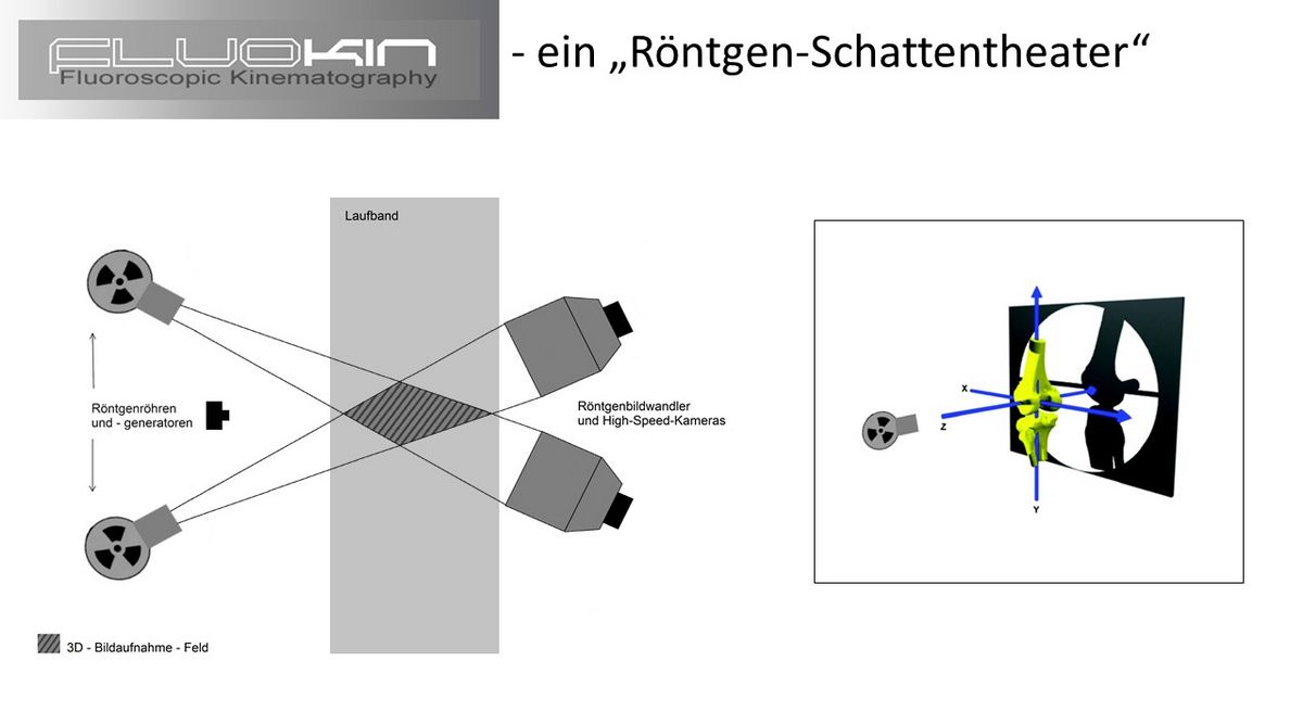 zur Vergrößerungsansicht des Bildes: Die Untersuchung mit FluoKin ist die bisher einzige Möglichkeit, zuverlässige und hochpräzise Aussagen über die Bewegung von Knochen, Gelenken und markierten Weichteilen im Raum zu treffen. Grafik: Franziska Wagner und Peter Böttcher