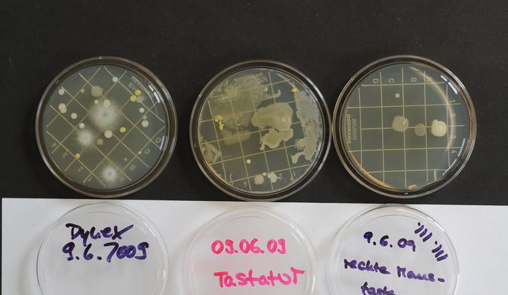 Glasschalen mit unterschiedlichen Bakterienkulturen