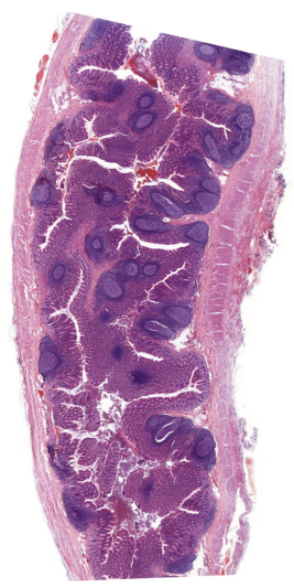Appendix: Der Längsschnitt des Wurmfortsatzes gibt eine Menge Aufschluss über dessen Zellstrukturen. Quelle: cuvm.uni-leipzig.de