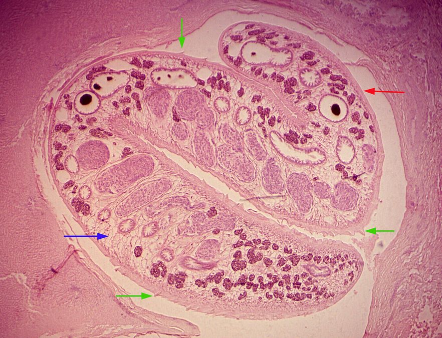 Trematode Fasciola: Der Saugwurm zeigt im Querschnitt deutlich erkennbare Gewebezellen und Zellstrukturen. Quelle: cuvm.uni-leipzig.de