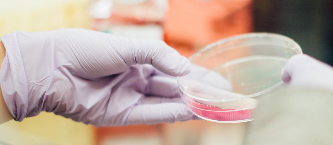 Zwei Hände halten eine Petrischale mit rosaner Flüssigkeit. Im Hintergrund sind Laborgegenstände zu erkennen. Foto: Drew Hays / Unsplash