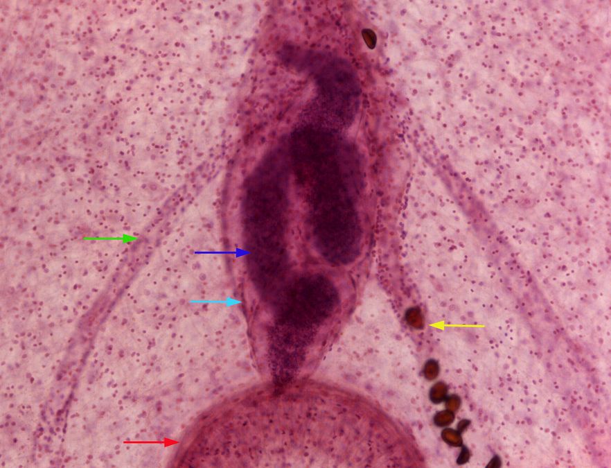 Trematode Dicrocoelium: Der Kleine Leberegel zeigt im Live Imaging bemerkenswerte Zellstruktuten. Quelle: cuvm.uni-leipzig.de
