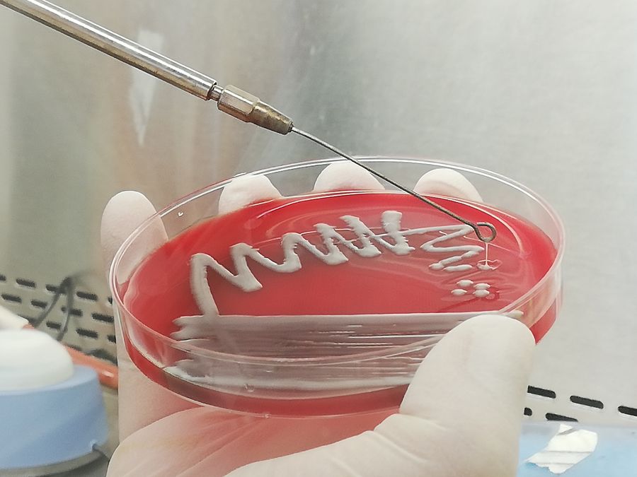 Ausstrich einer Bakterienkultur auf einer Blutplatte