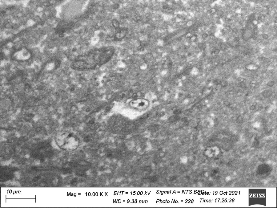 zur Vergrößerungsansicht des Bildes: TEM-Ultradünnschnitt vom Katzengehirn mit sichtbaren Neuronen und M yelin. Unter variablem Druck mikroskopiert. Foto: Dr. Reinert
