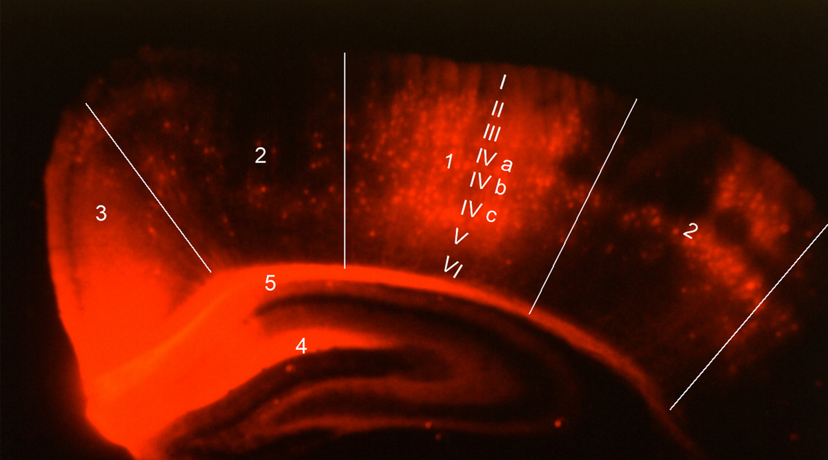 Die Fluoreszenzaufnahme zeigt die Schichten der Hirnrinde (I - VI), das Corpus callosum (5) und das Ammonshorn (4) des Hippokampus. Quelle: Professor Dr. Johannes Seeger