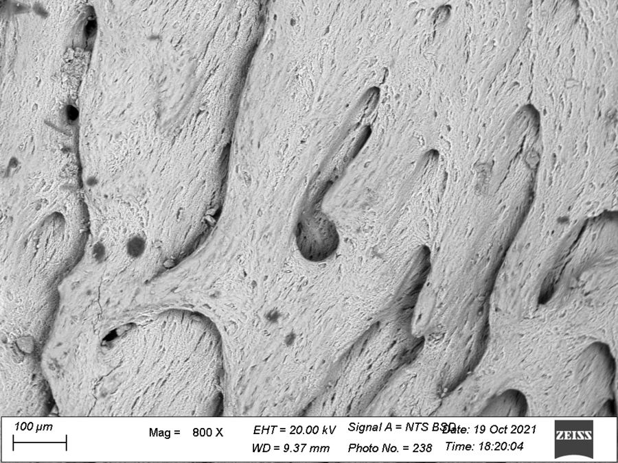 zur Vergrößerungsansicht des Bildes: REM-Bild vom Kieferknochen eines Wildschweins. Probe luftgetrocknet und unter variablem Druck mikroskopiert. Foto: Dr. Reinert
