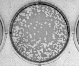 Darstellung eines Plaque-Assays