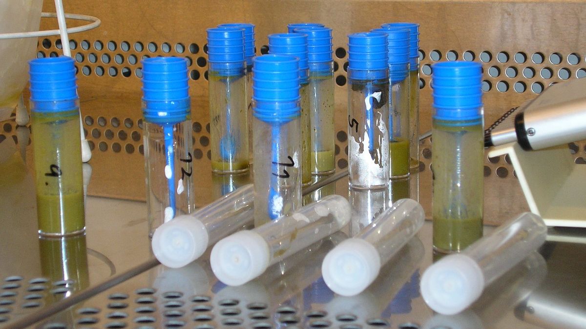 enlarge the image: Sample tubes, photo: Institute for Animal Hygiene and Veterinary Public Health